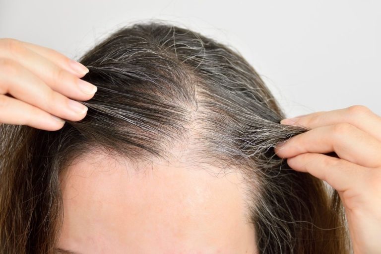 Est-ce que le stress donne des cheveux blancs quand on est jeune